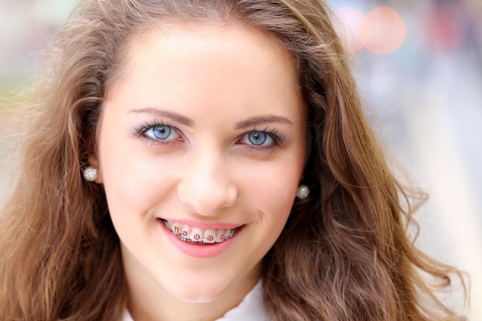 Braces In Boynton, FL